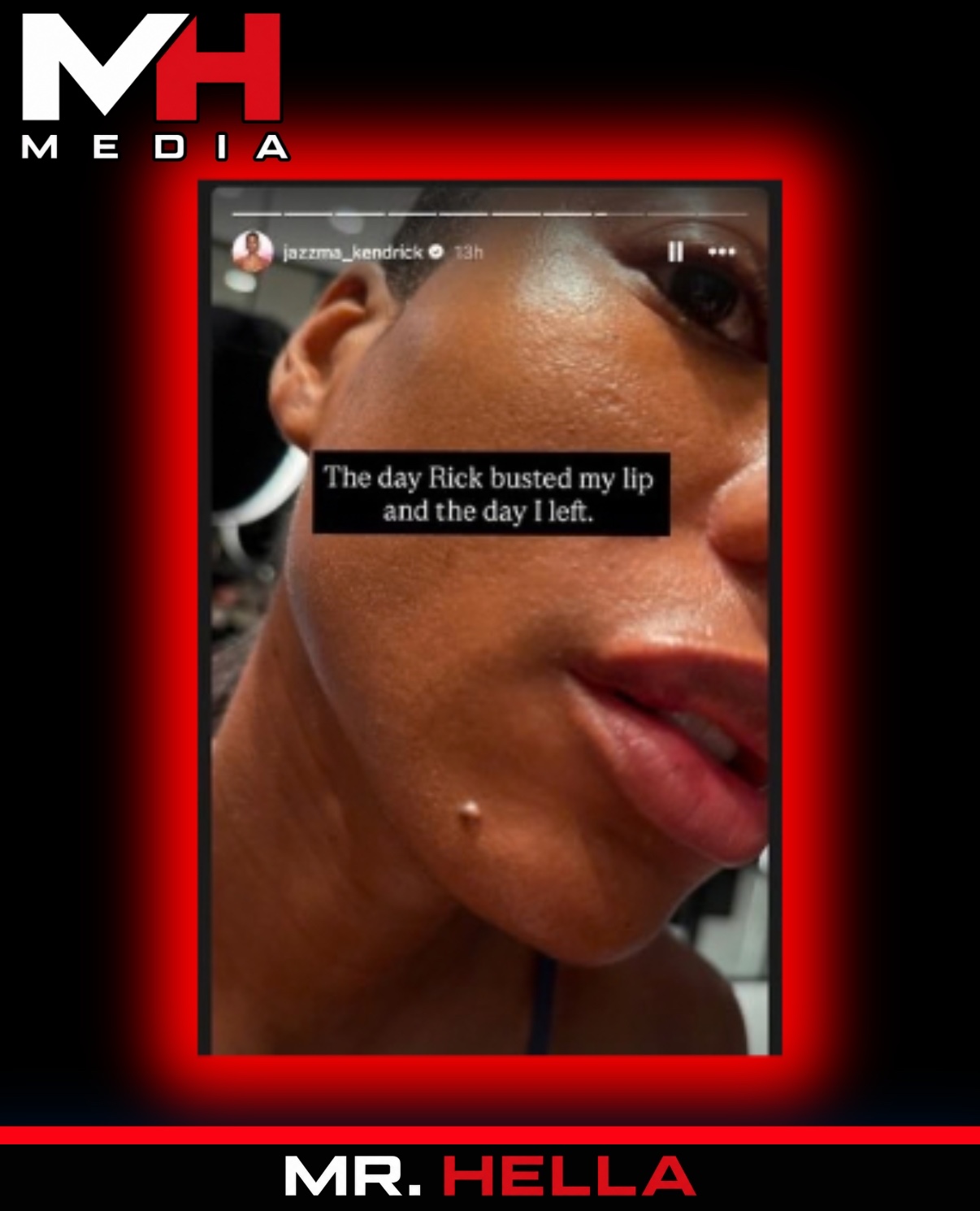 Rick Ross’ Ex Jazzma Kendrick Accuses Him of Physical Abuse, Shares Busted-Lip Photos — image 3