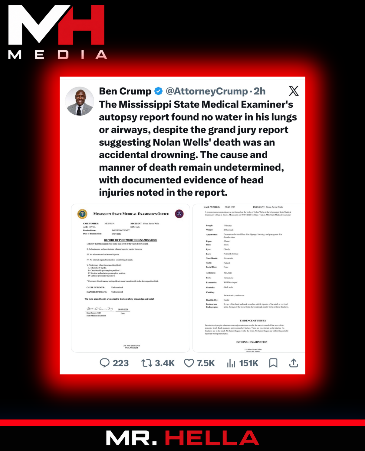 Nolan Wells Autopsy Found No Water in Airways or Stomach as Family Questions Drowning Theory — image 2