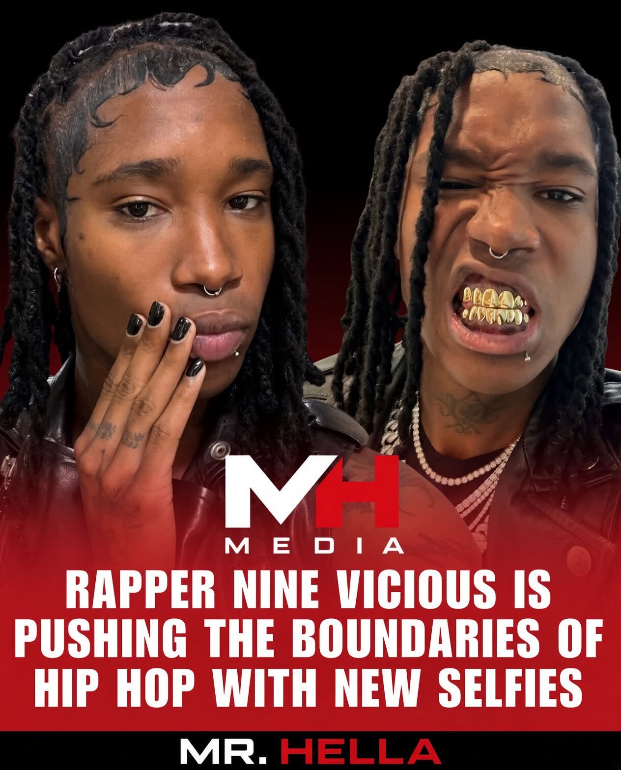 Nine Vicious posted selfies. Say Cheese and the quote accounts called it controversy