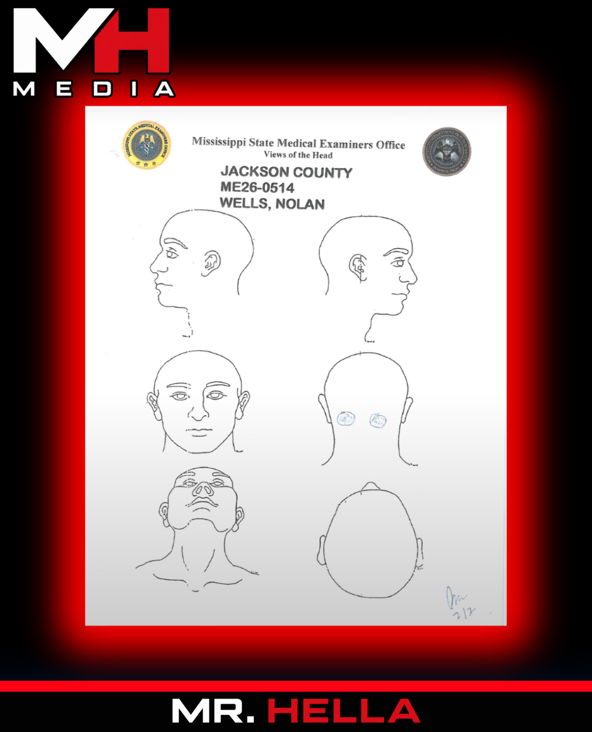 Nolan Wells Autopsy Found No Water in Airways or Stomach as Family Questions Drowning Theory — image 6