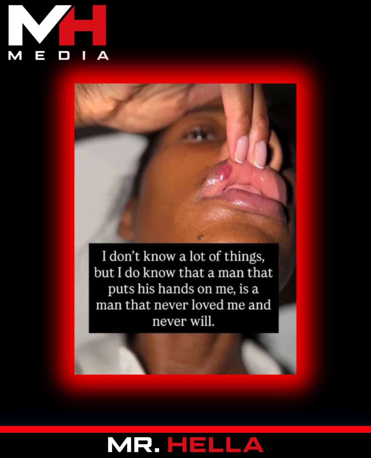 Rick Ross’ Ex Jazzma Kendrick Accuses Him of Physical Abuse, Shares Busted-Lip Photos — image 2